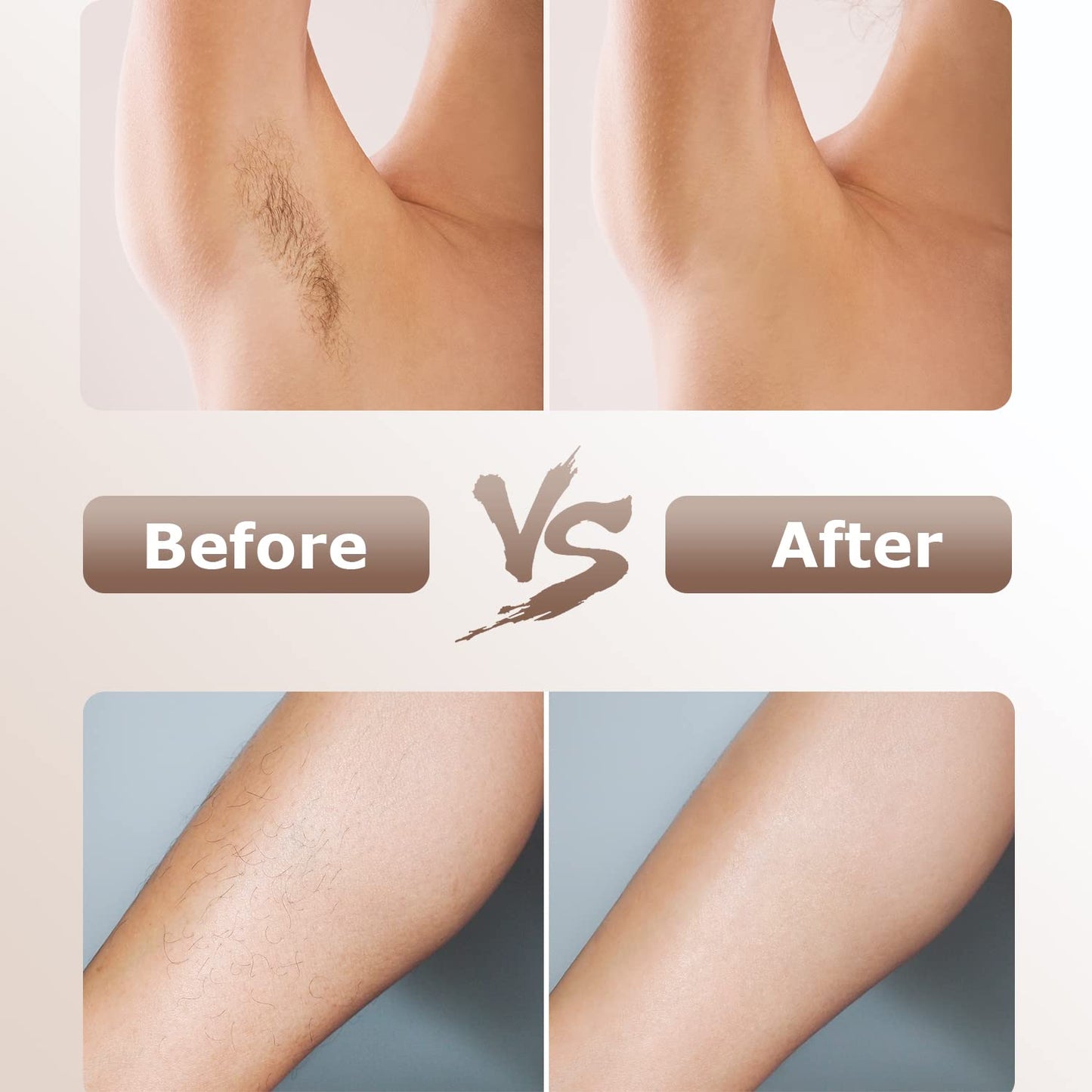 IPL Devices Hair Removal Laser
