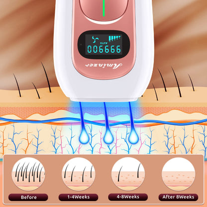 PA2 IPL Devices Hair Removal